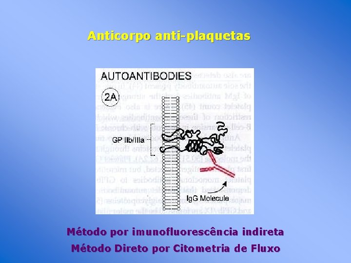 Anticorpo anti-plaquetas Método por imunofluorescência indireta Método Direto por Citometria de Fluxo 