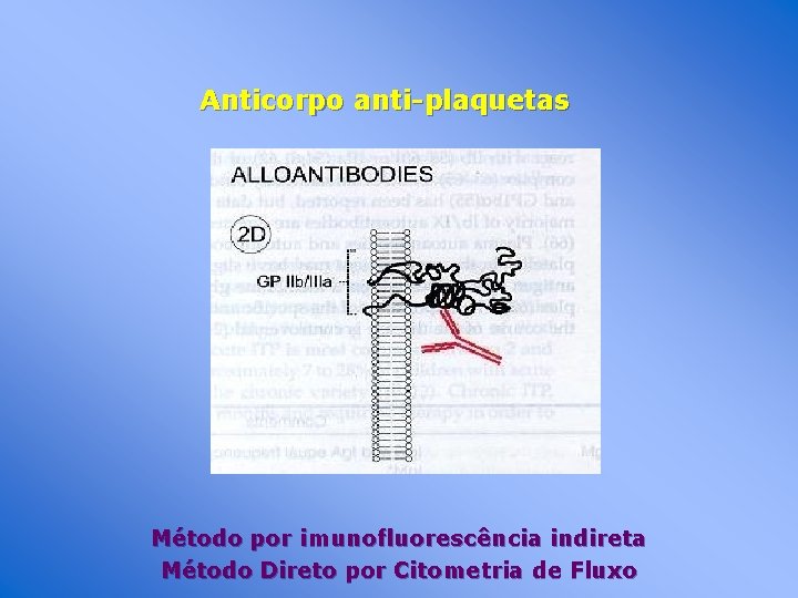 Anticorpo anti-plaquetas Método por imunofluorescência indireta Método Direto por Citometria de Fluxo 