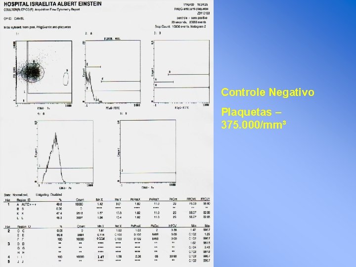 Controle Negativo Plaquetas – 375. 000/mm³ 0. 114 1. 47 