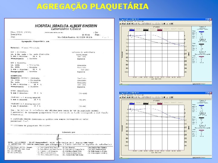 AGREGAÇÃO PLAQUETÁRIA 