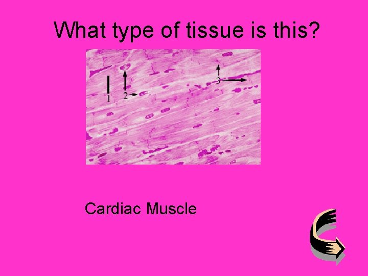 What type of tissue is this? Cardiac Muscle 