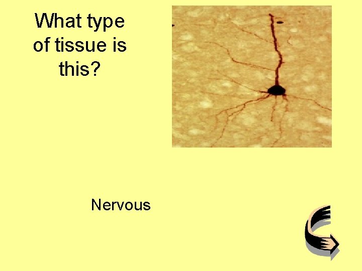 What type of tissue is this? Nervous 
