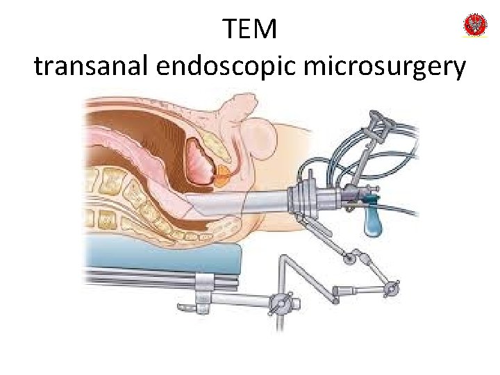 TEM transanal endoscopic microsurgery 