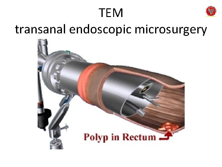 TEM transanal endoscopic microsurgery 