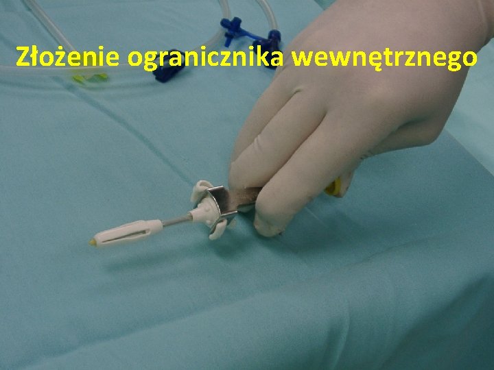 Złożenie ogranicznika wewnętrznego 