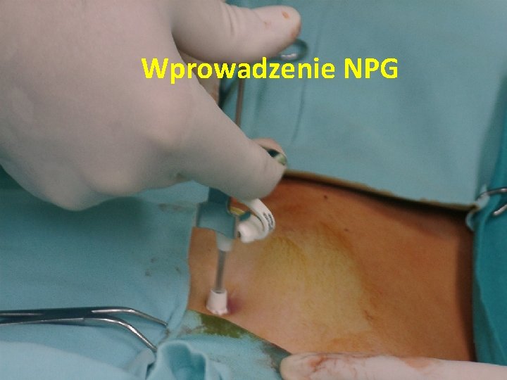 Wprowadzenie NPG 