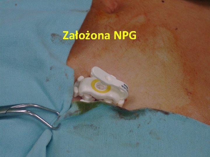 Założona NPG 