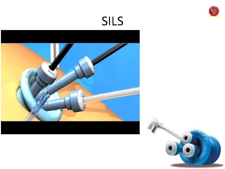 SILS 