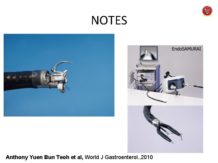 NOTES Anthony Yuen Bun Teoh et al, World J Gastroenterol. , 2010 