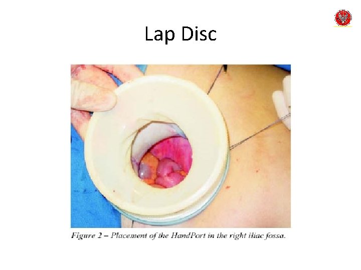 Lap Disc 