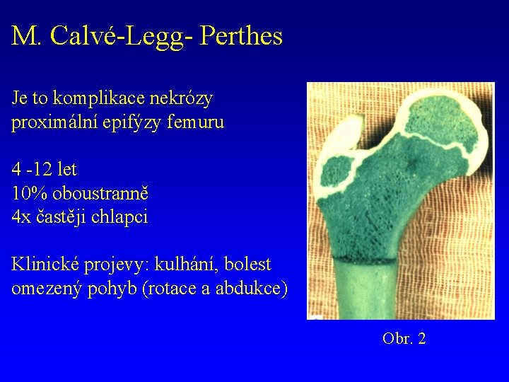 M. Calvé-Legg- Perthes Je to komplikace nekrózy proximální epifýzy femuru 4 -12 let 10%