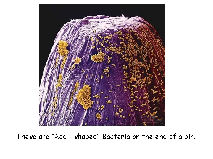These are “Rod – shaped” Bacteria on the end of a pin. 