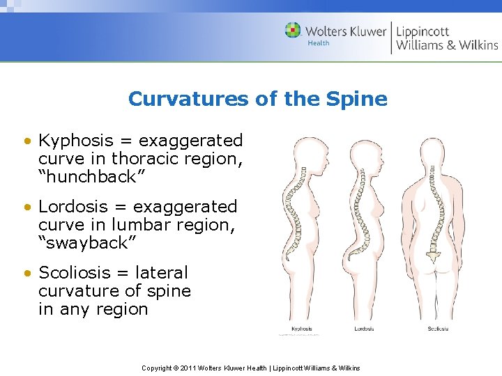 Curvatures of the Spine • Kyphosis = exaggerated curve in thoracic region, “hunchback” •