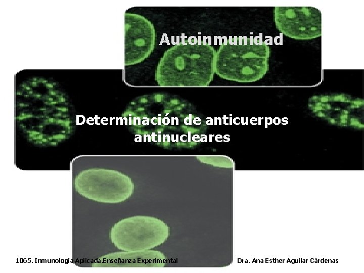 Autoinmunidad Determinación de anticuerpos antinucleares 1065. Inmunología Aplicada. Enseñanza Experimental Dra. Ana Esther Aguilar