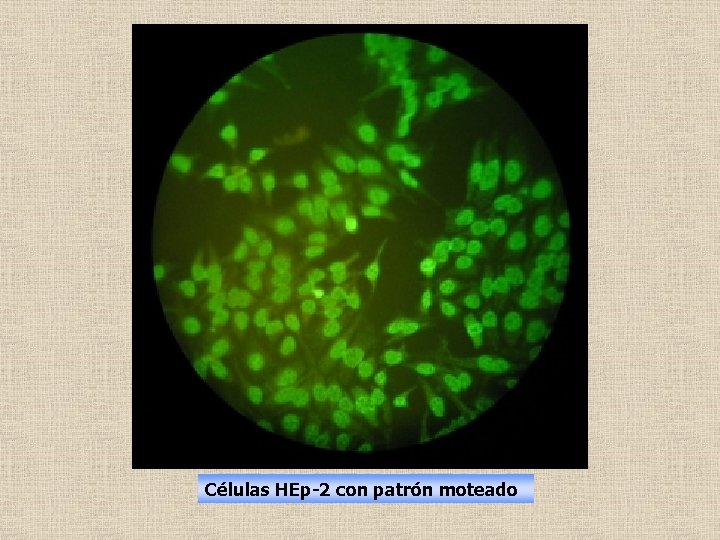 Células HEp-2 con patrón moteado 