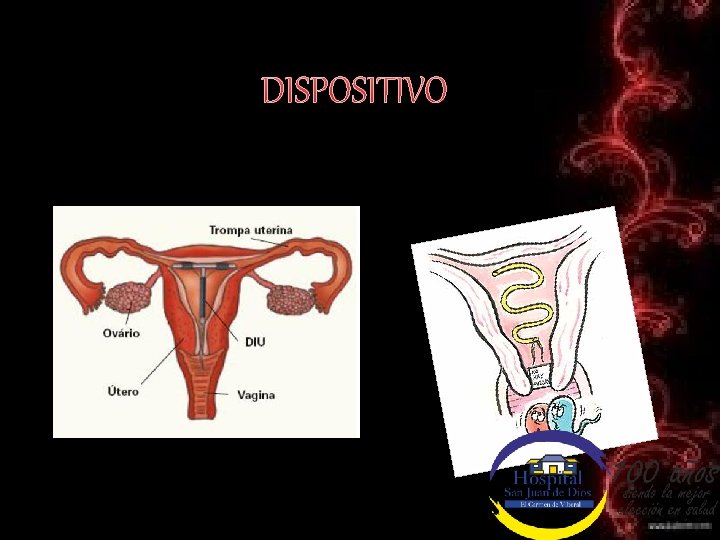 DISPOSITIVO 