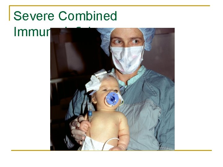Severe Combined Immunodeficiency 