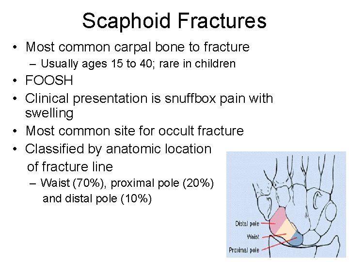 Scaphoid Fractures • Most common carpal bone to fracture – Usually ages 15 to