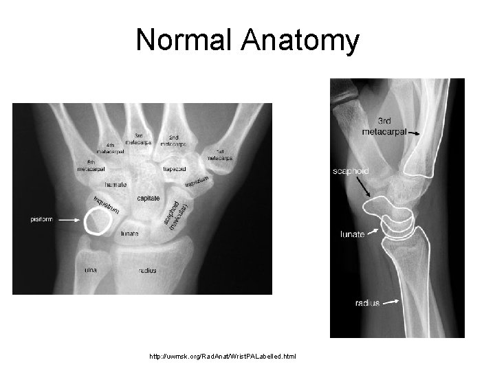 Normal Anatomy http: //uwmsk. org/Rad. Anat/Wrist. PALabelled. html 