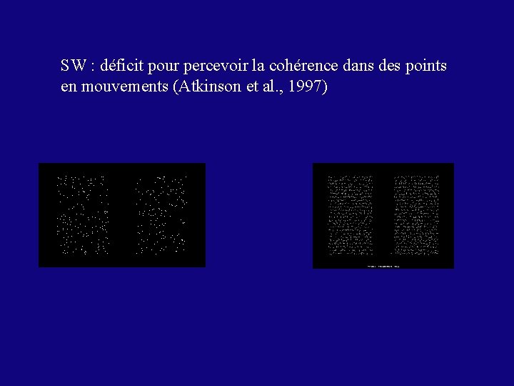 SW : déficit pour percevoir la cohérence dans des points en mouvements (Atkinson et