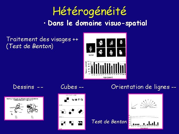 Hétérogénéité • Dans le domaine visuo-spatial Traitement des visages ++ (Test de Benton) Dessins