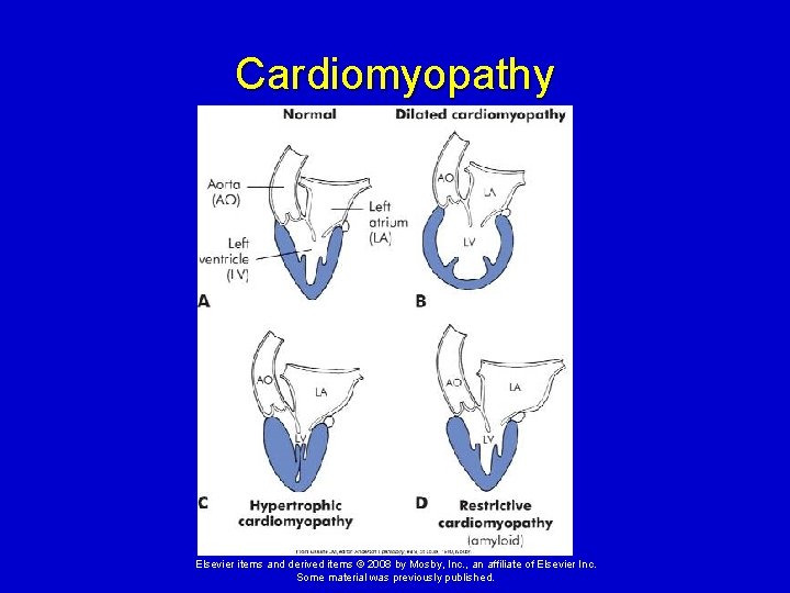 Cardiomyopathy Elsevier items and derived items © 2008 by Mosby, Inc. , an affiliate Cardiomyopathy Elsevier items and derived items © 2008 by Mosby, Inc. , an affiliate
