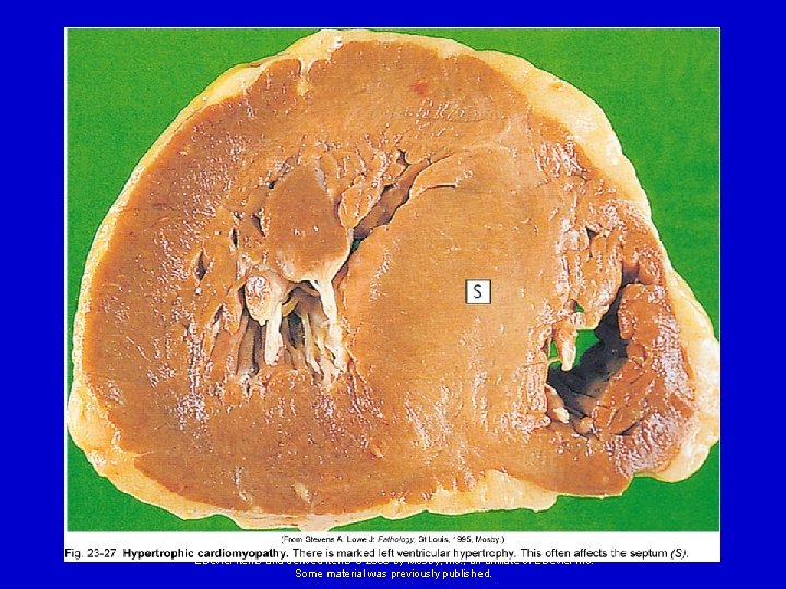 Elsevier items and derived items © 2008 by Mosby, Inc. , an affiliate of Elsevier items and derived items © 2008 by Mosby, Inc. , an affiliate of