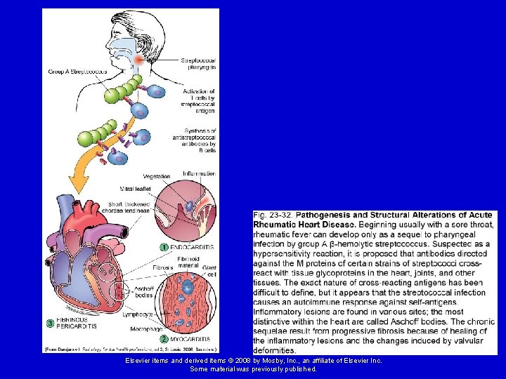 Elsevier items and derived items © 2008 by Mosby, Inc. , an affiliate of Elsevier items and derived items © 2008 by Mosby, Inc. , an affiliate of