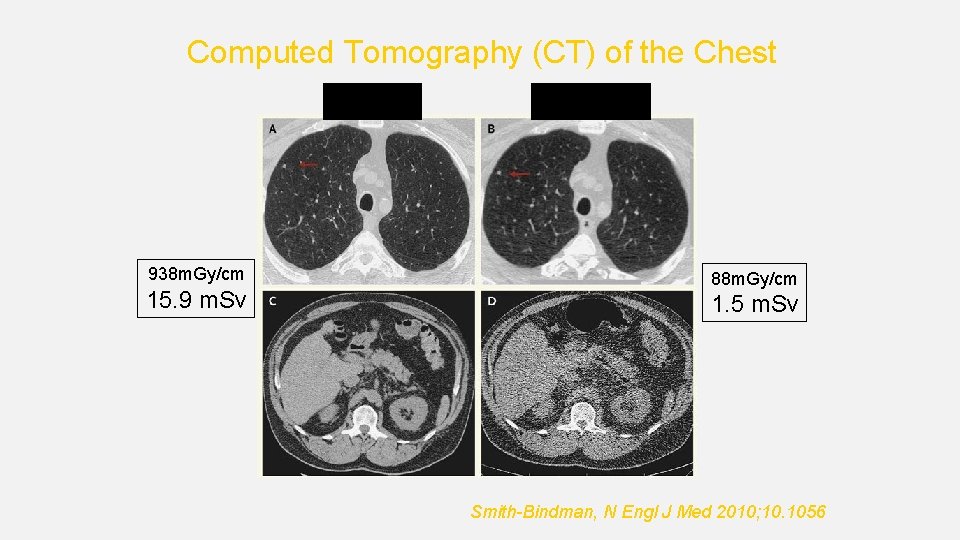 Computed Tomography (CT) of the Chest Routine 938 m. Gy/cm 15. 9 m. Sv