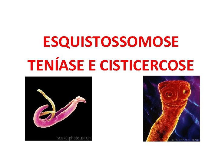 ESQUISTOSSOMOSE TENÍASE E CISTICERCOSE 