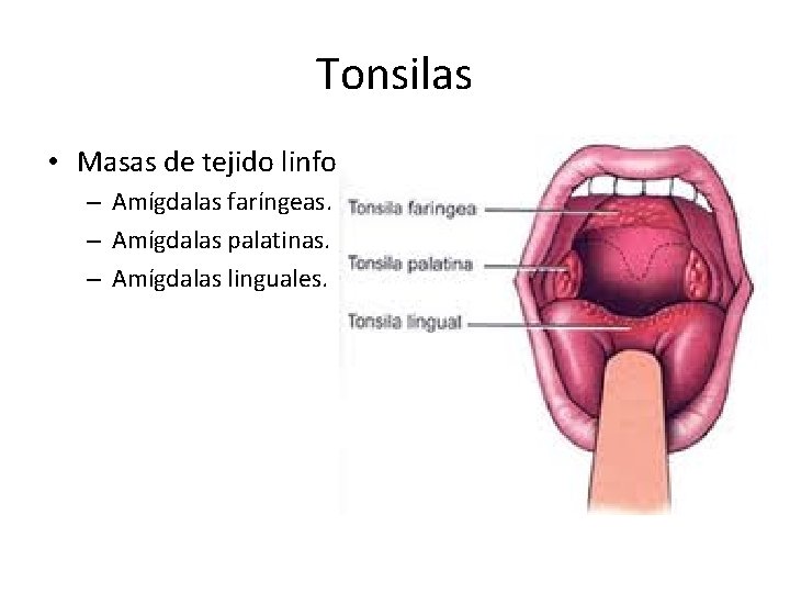 Tonsilas • Masas de tejido linfoide. – Amígdalas faríngeas. – Amígdalas palatinas. – Amígdalas