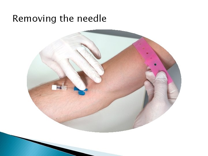 Removing the needle 
