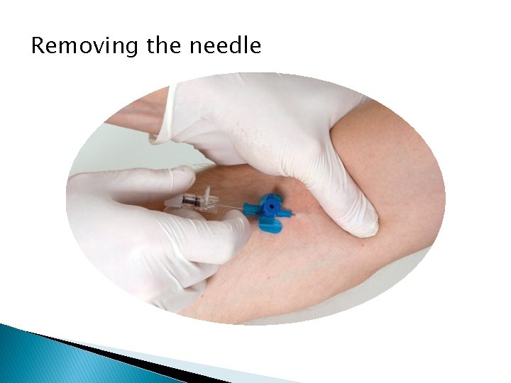 Removing the needle 