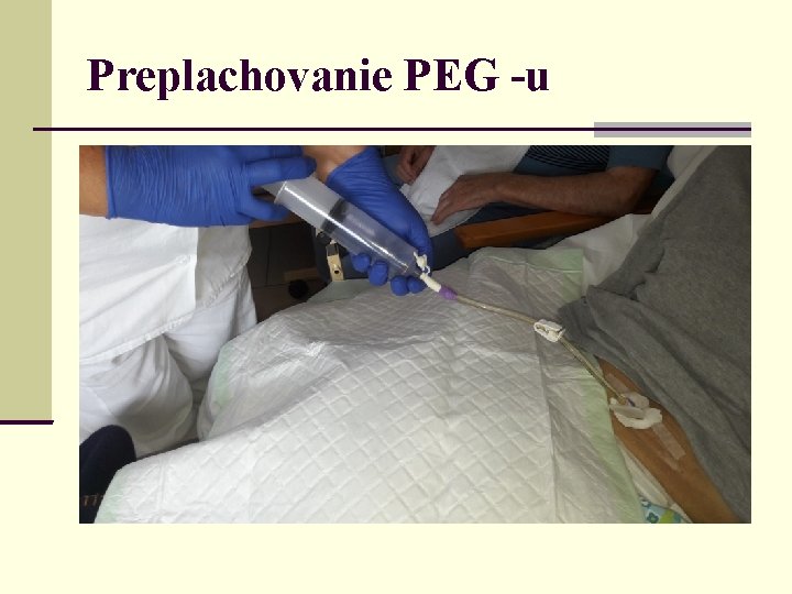 Preplachovanie PEG -u 