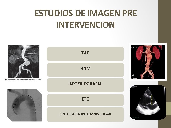 ESTUDIOS DE IMAGEN PRE INTERVENCION TAC RNM ARTERIOGRAFÍA ETE ECOGRAFIA INTRAVASCULAR 