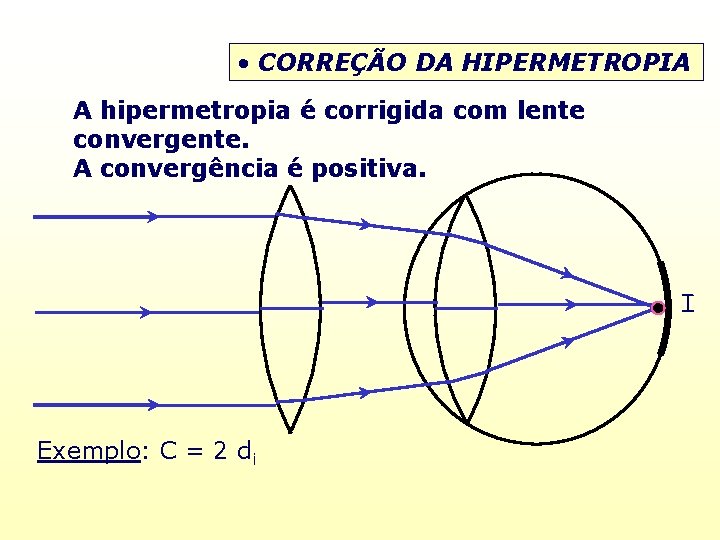  • CORREÇÃO DA HIPERMETROPIA A hipermetropia é corrigida com lente convergente. A convergência