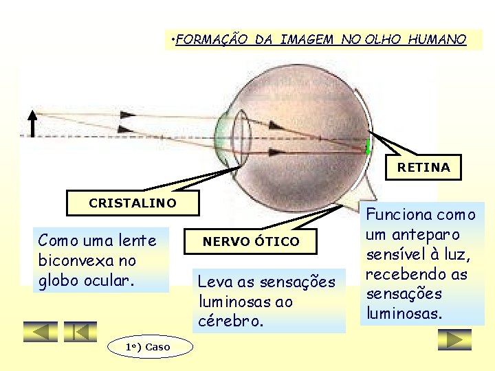  • FORMAÇÃO DA IMAGEM NO OLHO HUMANO RETINA CRISTALINO Como uma lente biconvexa