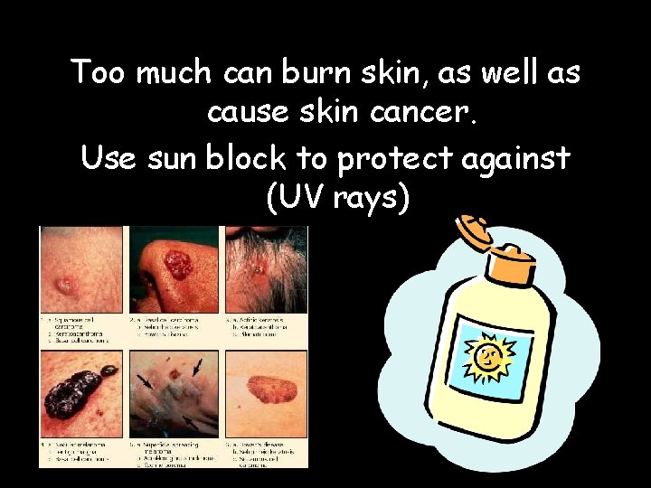 Too much can burn skin, as well as cause skin cancer. Use sun block