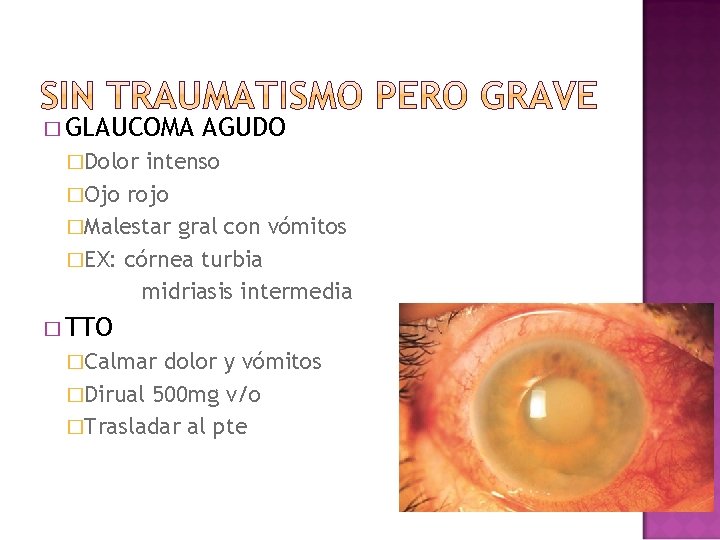 � GLAUCOMA AGUDO �Dolor intenso �Ojo rojo �Malestar gral con vómitos �EX: córnea turbia � GLAUCOMA AGUDO �Dolor intenso �Ojo rojo �Malestar gral con vómitos �EX: córnea turbia