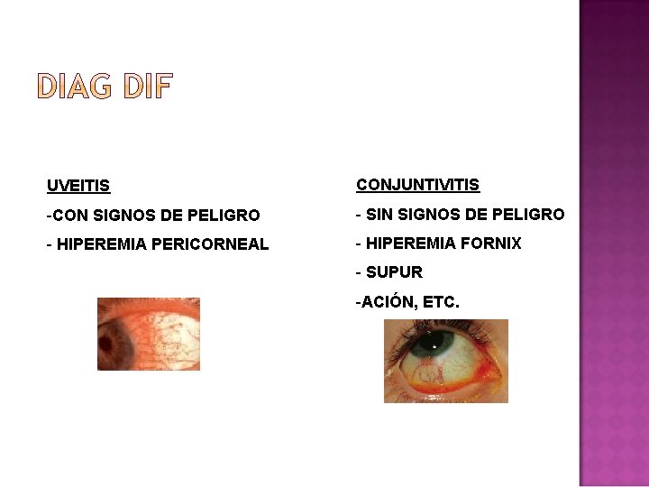 UVEITIS CONJUNTIVITIS -CON SIGNOS DE PELIGRO - SIN SIGNOS DE PELIGRO - HIPEREMIA PERICORNEAL UVEITIS CONJUNTIVITIS -CON SIGNOS DE PELIGRO - SIN SIGNOS DE PELIGRO - HIPEREMIA PERICORNEAL