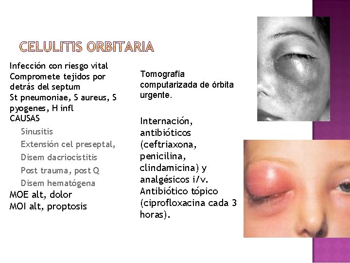 Infección con riesgo vital Compromete tejidos por detrás del septum St pneumoniae, S aureus, Infección con riesgo vital Compromete tejidos por detrás del septum St pneumoniae, S aureus,