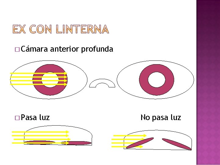 � Cámara � Pasa luz anterior profunda No pasa luz � Cámara � Pasa luz anterior profunda No pasa luz