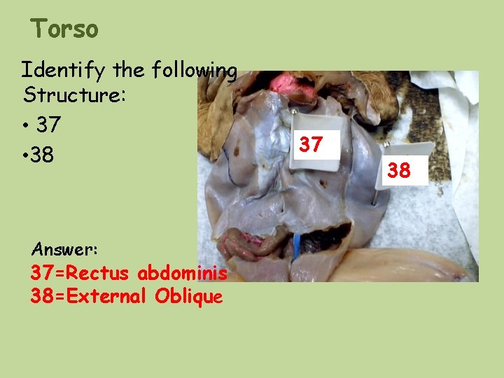 Torso Identify the following Structure: • 37 • 38 Answer: 37=Rectus abdominis 38=External Oblique Torso Identify the following Structure: • 37 • 38 Answer: 37=Rectus abdominis 38=External Oblique