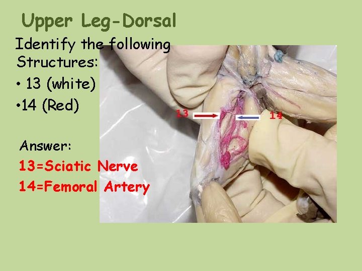 Upper Leg-Dorsal Identify the following Structures: • 13 (white) • 14 (Red) Answer: 13=Sciatic Upper Leg-Dorsal Identify the following Structures: • 13 (white) • 14 (Red) Answer: 13=Sciatic