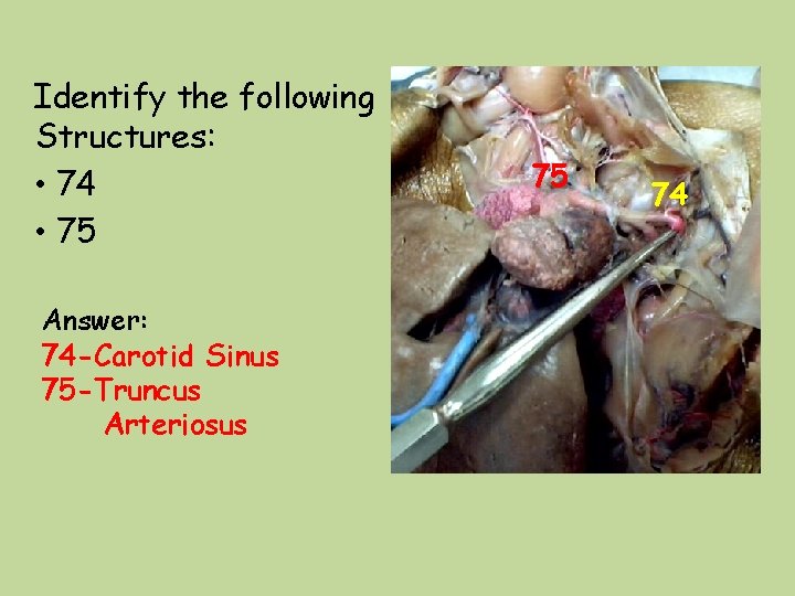 Identify the following Structures: • 74 • 75 Answer: 74 -Carotid Sinus 75 -Truncus Identify the following Structures: • 74 • 75 Answer: 74 -Carotid Sinus 75 -Truncus