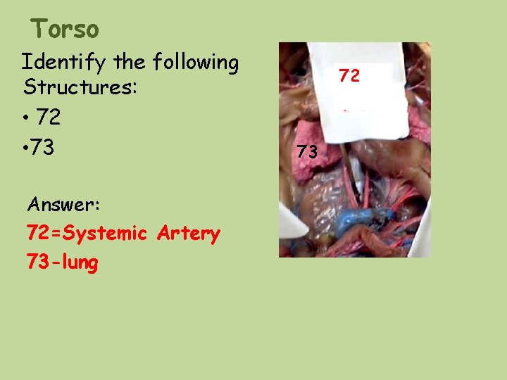 Torso Identify the following Structures: • 72 • 73 Answer: 72=Systemic Artery 73 -lung Torso Identify the following Structures: • 72 • 73 Answer: 72=Systemic Artery 73 -lung