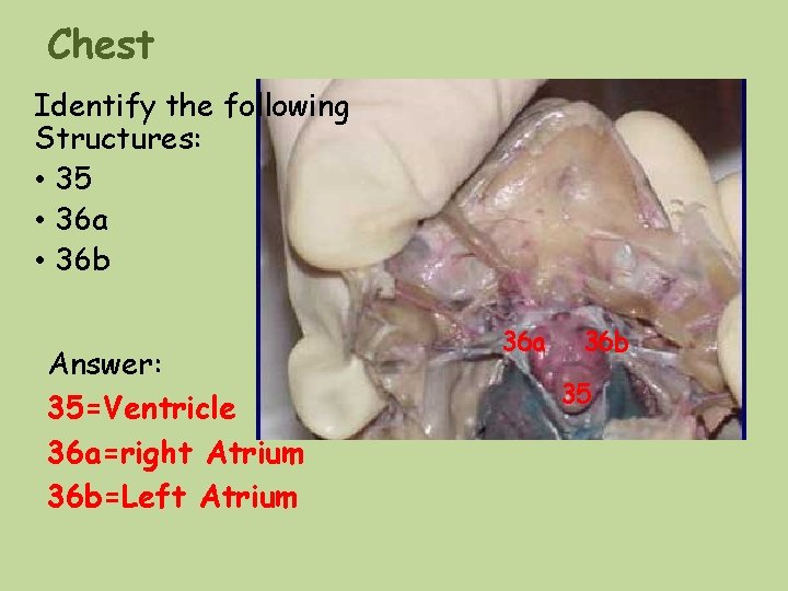 Chest Identify the following Structures: • 35 • 36 a • 36 b Answer: Chest Identify the following Structures: • 35 • 36 a • 36 b Answer: