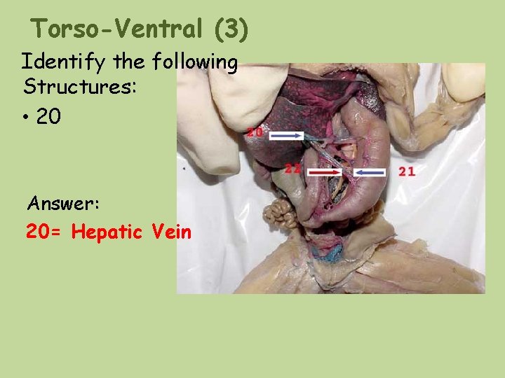 Torso-Ventral (3) Identify the following Structures: • 20 Answer: 20= Hepatic Vein Torso-Ventral (3) Identify the following Structures: • 20 Answer: 20= Hepatic Vein