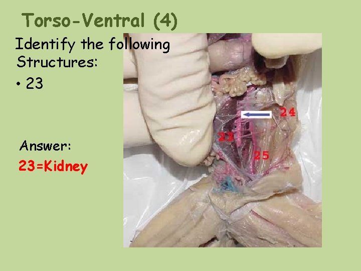 Torso-Ventral (4) Identify the following Structures: • 23 Answer: 23=Kidney Torso-Ventral (4) Identify the following Structures: • 23 Answer: 23=Kidney