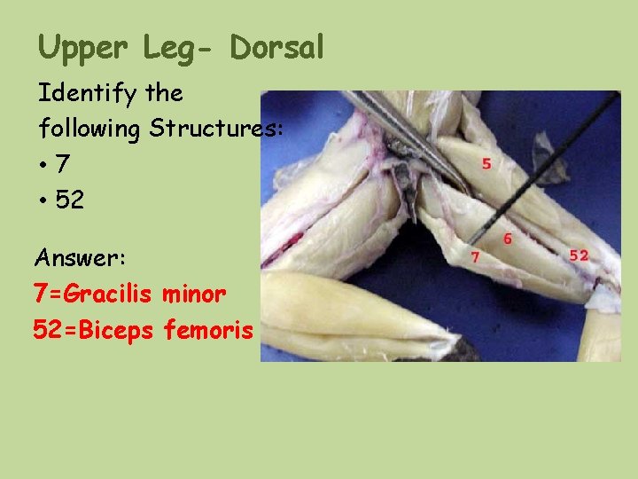Upper Leg- Dorsal Identify the following Structures: • 7 • 52 Answer: 7=Gracilis minor Upper Leg- Dorsal Identify the following Structures: • 7 • 52 Answer: 7=Gracilis minor
